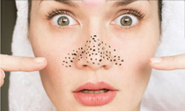 رژیم غذایی و جوش های سرسیاه